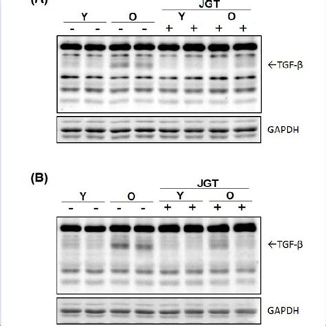 Western blot analysis of TGF β expression in tibialis anterior A and