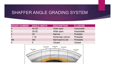 Gonioscopy and methods to assess anterior segments