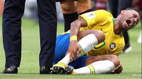 Brasil Rugi Besar Ankle Neymar Bengkak Saat Brasil Kontra Serbia