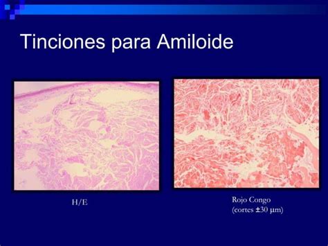 Tinciones Histologicas Autoguardado Ppt