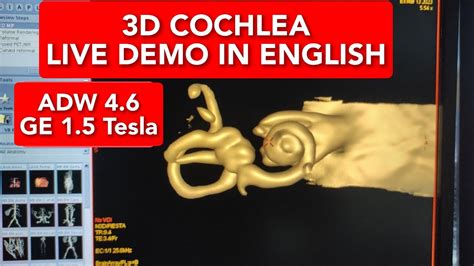 3d Cochlea On Adw 46 Live Demo In English Youtube