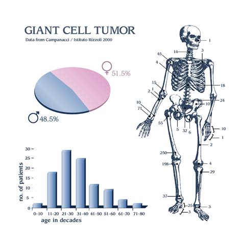 Giant Cell Tumor Foot And Ankle