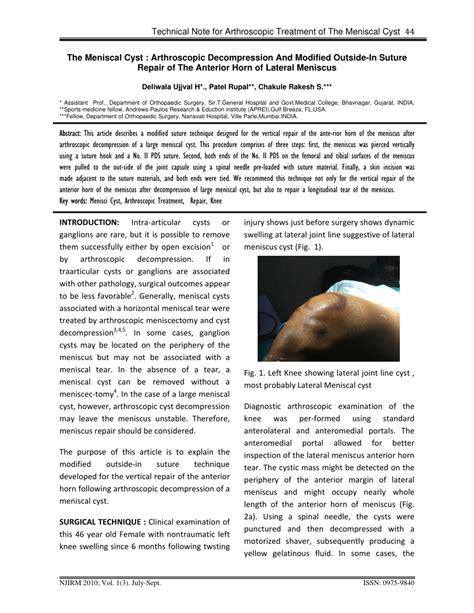 PDF The Meniscal Cyst Arthroscopic Decompression And Modified