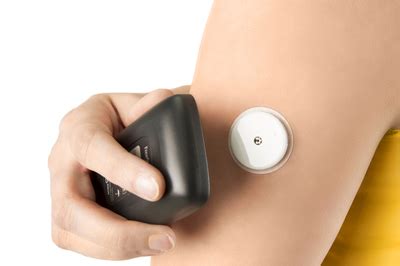 Flash Glukose Monitoring Mit Freestyle Libre Diabetes News Diabetes