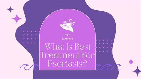 What Is Best Treatment For Psoriasis? by carlstewart06 - Issuu