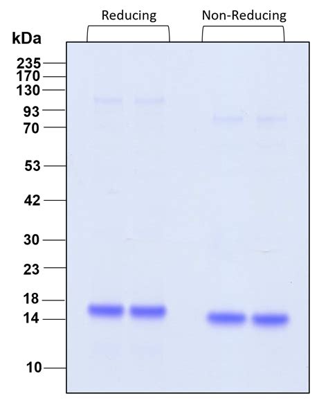 Humankine® Recombinant Human Il 21 Protein Proteintech