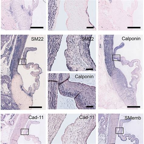 Valvular Interstitial Cell Vic Markers Tile Scans Of Sheep Aortic