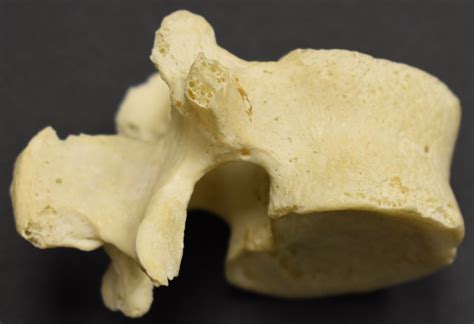 Lumbar Vertebra Lateral View Diagram Quizlet