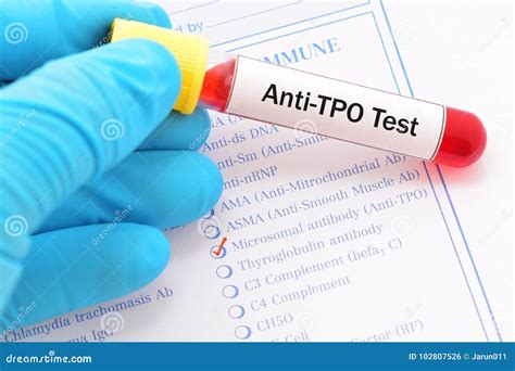 Anti-TPO test stock photo. Image of autoantibodies, erythematosus ...