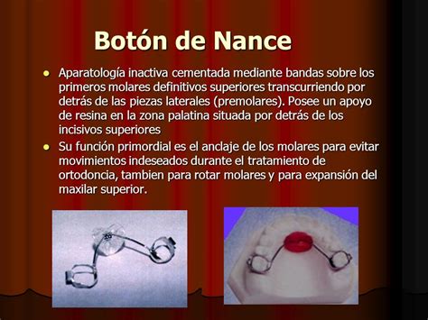 Correspondencia Escalera Alentar Boton De Nance Ortodoncia Hip Tesis