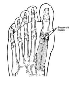 Sesamoid Injuries Foot And Ankle Specialists Of Middle Tennessee