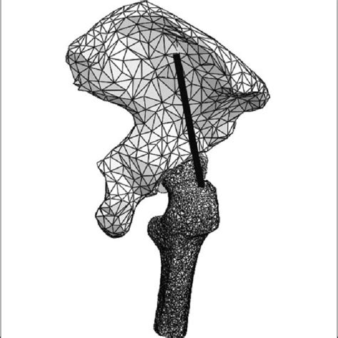 A Black Line At The Sagittal View Of Pelvis Designating Gluteus Medius