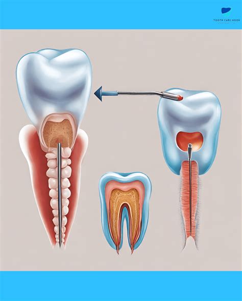 What is Bicuspid Tooth | All You Need to Know