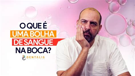 O que é uma bolha de sangue na boca YouTube