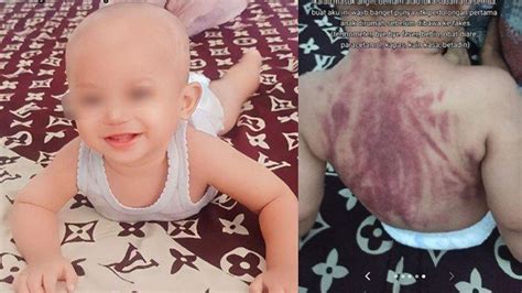 Alasan Pilu Di Balik Pengasuh Viral Kerok Punggung Bayi 15 Bulan Sampai