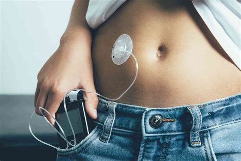 Insulin Pump Therapy Types Benefits And Management