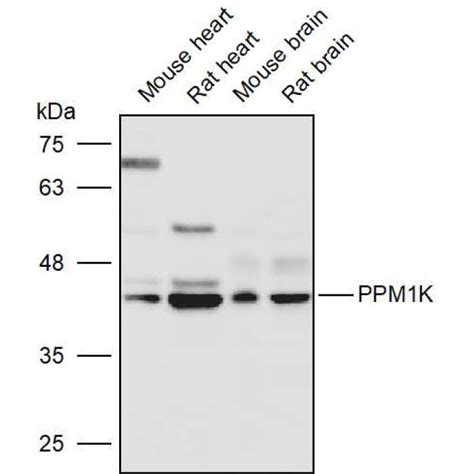 Solarbio K111264P Anti PPM1K Polyclonal Antibody 试剂仪器耗材