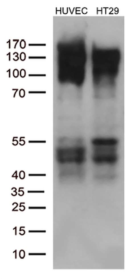 FGFR2 Monoclonal Antibody OTI1D3 TrueMAB OriGene 100 μL