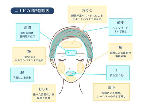 【完全版】ニキビの治し方まとめ！即効性のある対策法と効果的なケア方法 ハダメディア By Bihadadotokyo