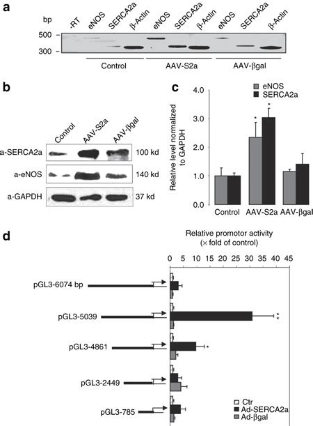 Serca2a Overexpression Increases Nos Expression In Hcaec A Reverse Download Scientific