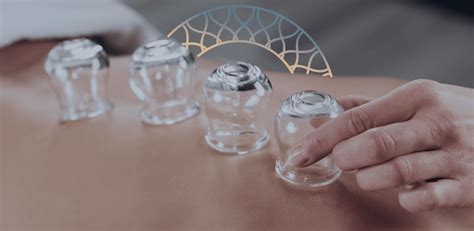 Dry And Wet Cupping Therapy Dubai Dry Cupping Therapy Wet Cupping Therapy