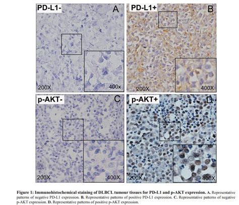 Phospho Akt123 Ser473 Antibody Affinity Biosciences Ltd亲科生物官网