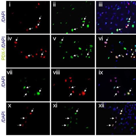 Nuclear Localization Of Pdx 1 Induced Pancreatic Transcription Factor