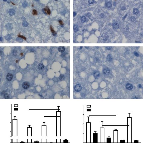 Phenotype of wild type WT and ADAMTS 13 deficient Adamts 13 À À