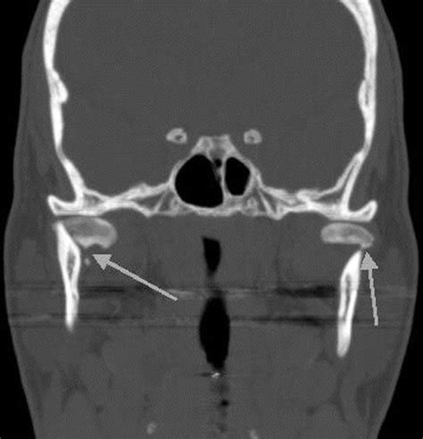 Cross Sectional And Functional Imaging Of The Temporomandibular Joint