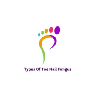 Types Of Toenail Fungus Online Presentations Channel