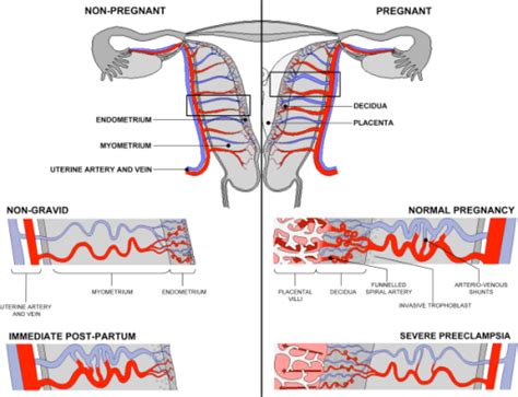 Uterine Arteries Anatomy