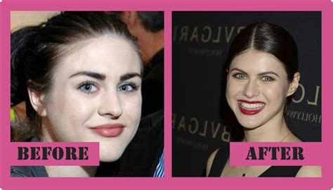 Frances Bean Cobain Plastic Surgery Inspiring Your Life