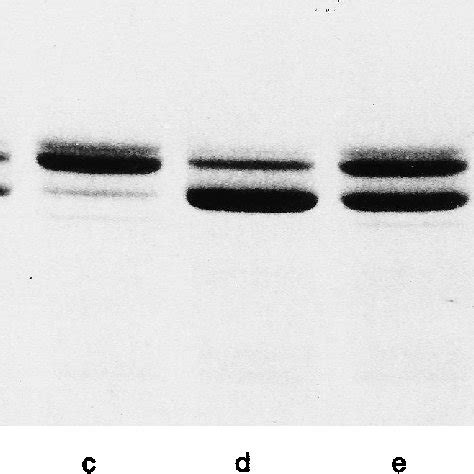 Electrophoretic Separation Of Myosin Heavy Chain Isoforms In Extensor