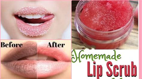 How To Get Rid Of Dark Lips Homemade Lip Scrub For Pink And Soft Lips Youtube