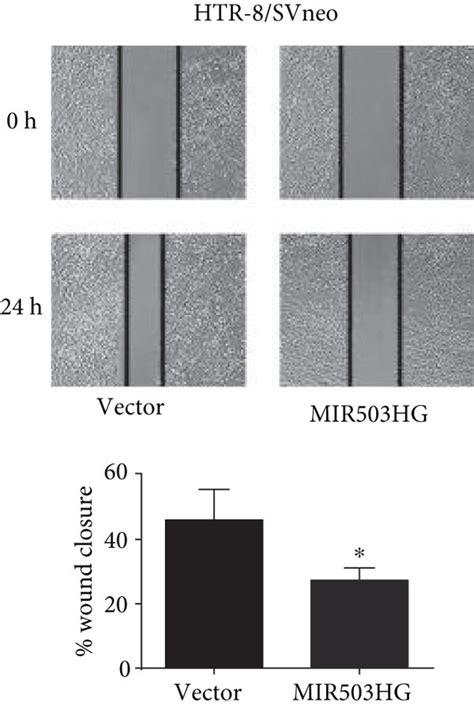 Upregulation Of Mir Hg Suppressed Trophoblast Cell Proliferation