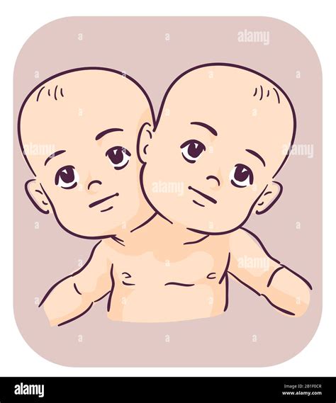 Illustration of Kids Boys Joined Together as Conjoined Twins, Wearing One Shirt Stock Photo - Alamy