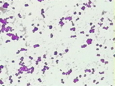 Cocci Bacteria Under Microscope