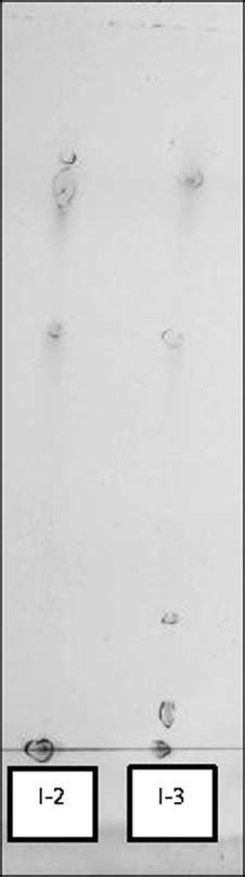 An Example Of A Developed TLC Chromatogram The Solvent Front Form The