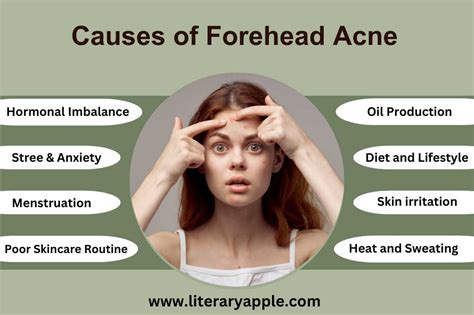 Forehead Acne Causes And Treatments Literary Apple