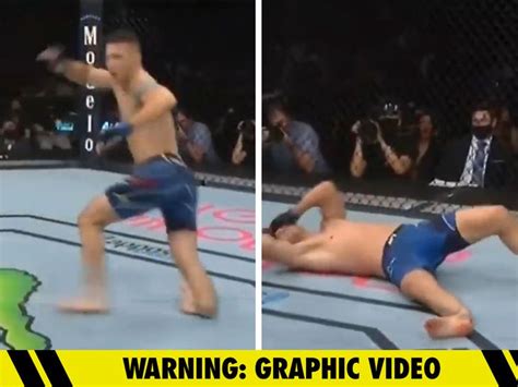 Chris Weidman Suffers Gruesome Leg Injury in UFC Fight against Uriah Hall