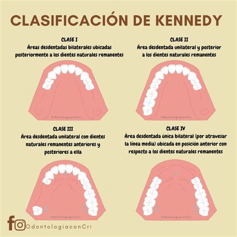 Pin on Odontología