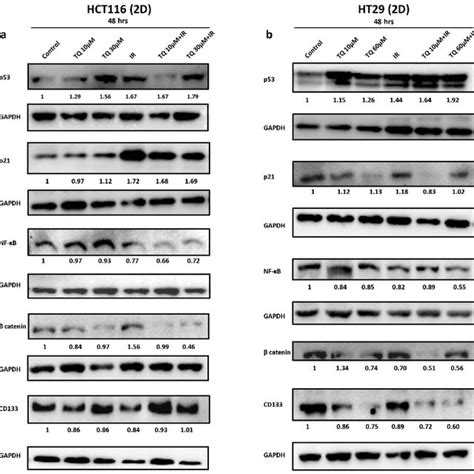 Tq Sensitizes Colorectal Cancer Cells To Radiation Through Targeting