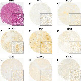 Representative H E And Immunohistochemistry Images Among The Immune