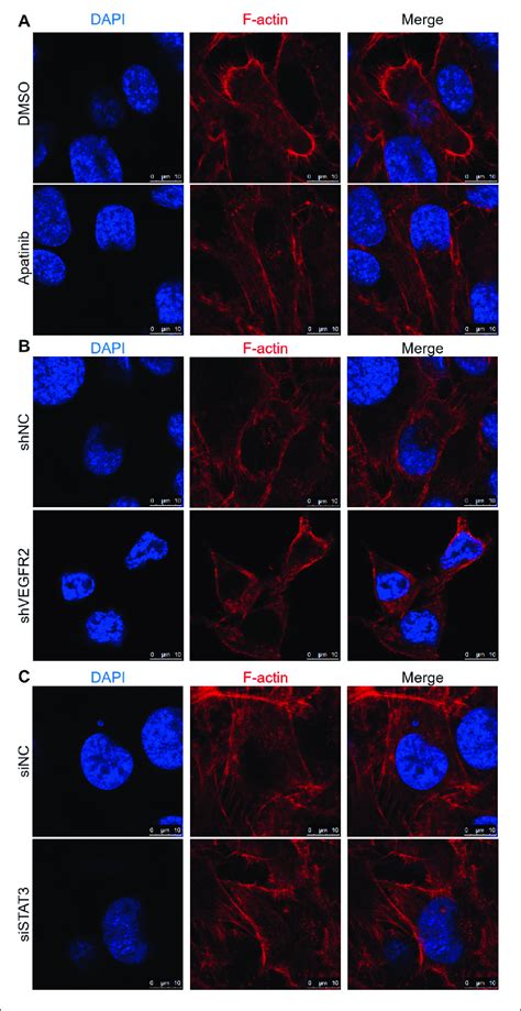 Vegfr2 And Stat3 Expression Influences Osteosarcoma Cell Cytoskeletal