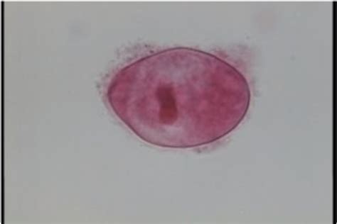 Parasitology Flashcards Quizlet