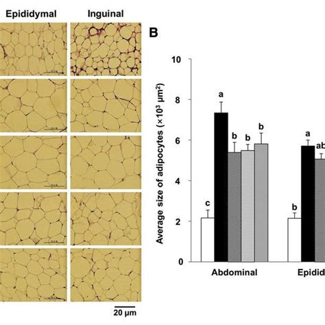 Histology Of Wat And Mean Adipocyte Size In Hfd Fed C Bl J Mice I