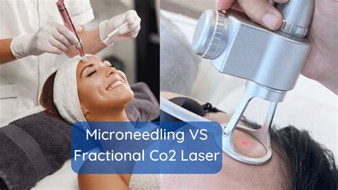 Microneedling Vs Laser Skin Resurfacing Machine Which Is Right For