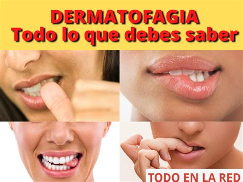 Dermatofagia Sintomas Causas Y Tratamiento Todo En La Red