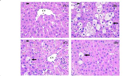 Histology Of The Liver From Rats Receiving Only Vehicle A Ccl B