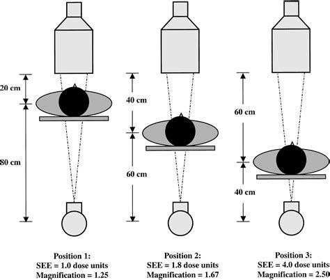 Fluoroscopy Patient Radiation Exposure Issues Radiographics